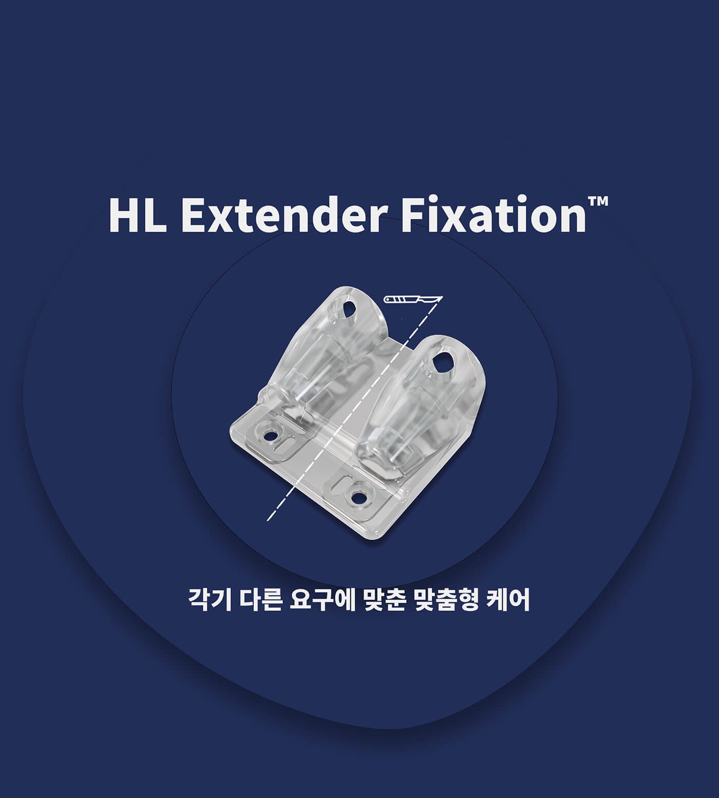 HL Extender Fixation